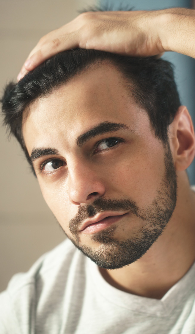 Man Worried For Alopecia Checking Hair For Loss