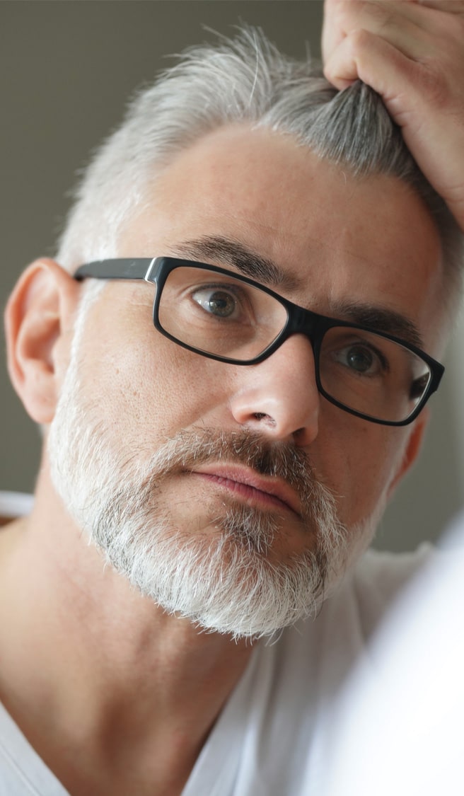 Portrait of man concerned by hair loss Portrait of man concerned by hair loss